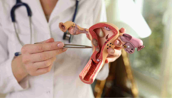 How to Choose the Right Clinic for PCOS Treatment in Bangalore Without Overspending
