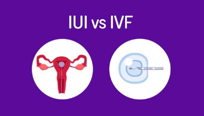 IUI vs. IVF: Which Is Right for You?