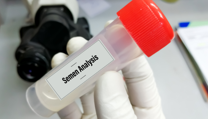 Semen Analysis and DFI Test: Complete Guide to Male Fertility Evaluation